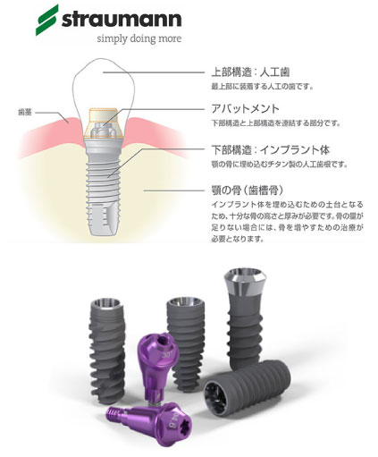 ストローマン社製インプラントシステム
